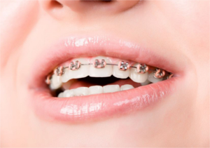 ortodonta, ortodoncja