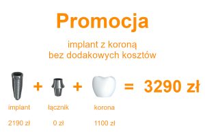 implant z korona promocja 3290 zł